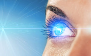 Traditional LASIK vs. All-laser LASIK