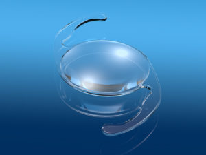Artificial lens implants in New York City